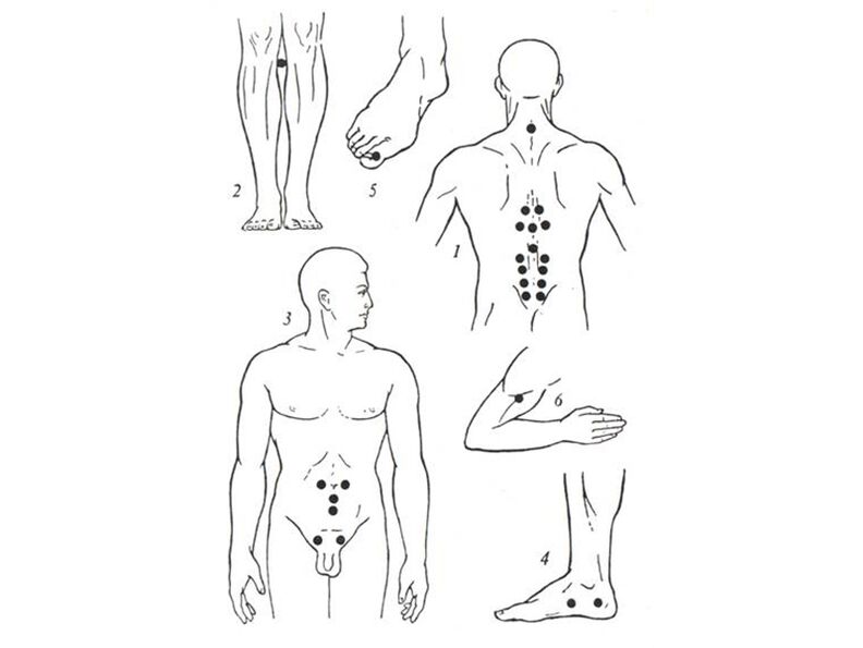 Massage de l'acupuncture